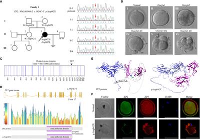 Identification of zona pellucida defects revealed a novel loss-of-function mutation in ZP2 in humans and rats